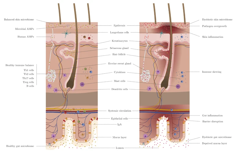 The Gut-Skin Axis
