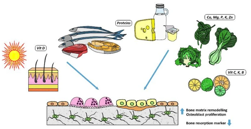 The Role Of Diet In Osteoporosis Prevention